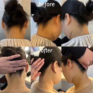 うなじ脱毛/美肌脱毛 LABELのエステ・リラクイメージ