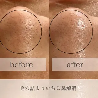 yokohama 🎀miaのマツエク・マツパデザイン