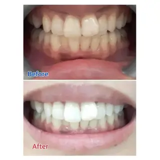 M渋谷店所属・M渋谷 ホワイトニングのエステ・リラクイメージ