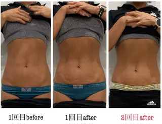 🔰 新米ネイリストのネイルデザイン