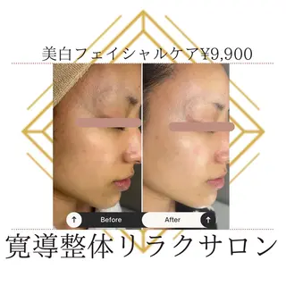 矢ヶ部 寛之のエステ・リラクイメージ