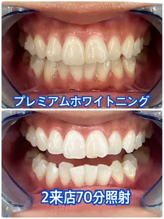 Platinum Beauty 四条烏丸店所属・吉田亮利 ホワイトニング専門店のその他イメージ