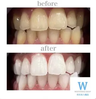 ホワイトニング ショップ本八幡店のエステ・リラクイメージ