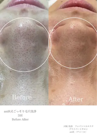北浜/毛穴洗浄ツヤ肌 サロンaniRのエステ・リラクイメージ