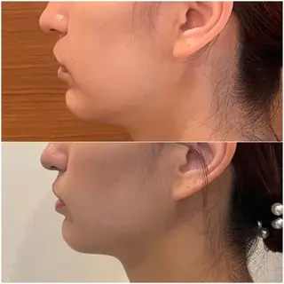 Chio-RE所属・Wax/絹肌艶肌🌼 坂結加のエステ・リラクイメージ