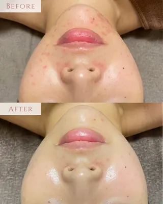 肌質改善サロン LesFleursのエステ・リラクイメージ