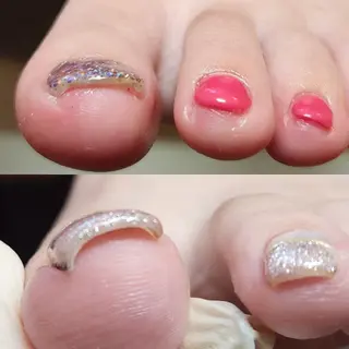 ネイル Micky nail chikushinoのネイルデザイン