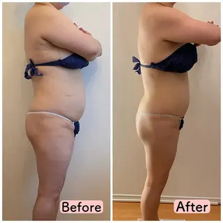 痩身リラク専門サロン 〜LUCIALL 〜のエステ・リラクイメージ