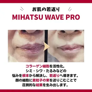 SHAPY HIGH SLIMMING ESTHETIC所属・嚴 キララのエステ・リラクイメージ