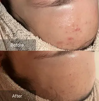 for woman所属・森 美優のエステ・リラクイメージ