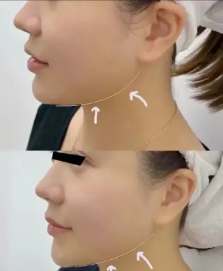 マツエク・マツパ aliaハイフ&水光ジェットサロン所属・aliaハーブ水光店 エステティシャン募集のエステ・リラクイメージ