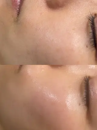 ビューティーサロン Lino🫧mayuのエステ・リラクイメージ