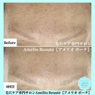 毛穴ケア専門サロン Amélio Beauté所属・毛穴ケア専門サロン アメリオボーテのその他イメージ