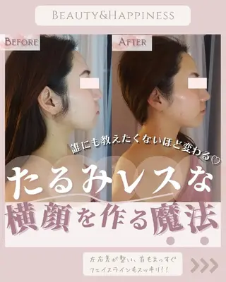 痩身ハーブピーリング 筋膜リリース☆B&Hのエステ・リラクイメージ