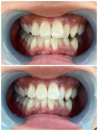 Belle beauty salon所属・Bellebeau tysalonのエステ・リラクイメージ