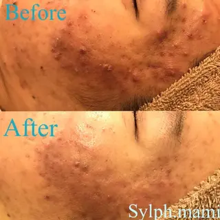 毒素出し専門サロンSylph(なかがわ整骨院併設サロン)所属・Mami Hataのエステ・リラクイメージ