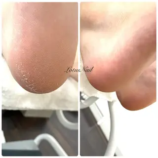 ネイル Lotus Nailのネイルデザイン