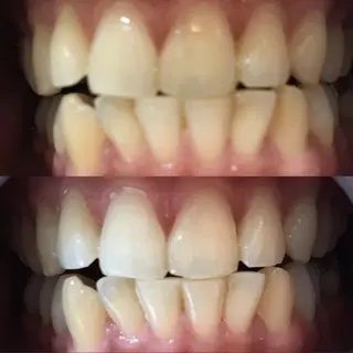 LBSホワイトニング 銀座店💎スタッフ峯のその他イメージ