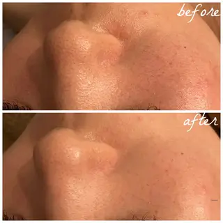 メンズ メナード岐阜市茜部 杉浦のエステ・リラクイメージ