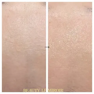 ビューティー ミロワールのエステ・リラクイメージ