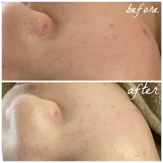 メンズ メナード岐阜茜部 杉浦のエステ・リラクイメージ