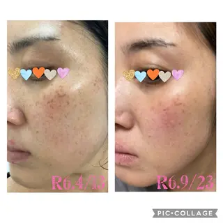 ECLAT エクラ所属・寺山 千鶴のネイルデザイン