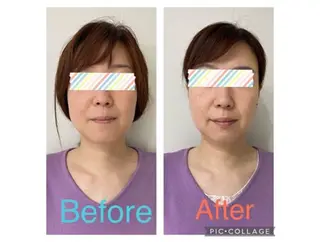 フェイシャルエステ ルフル ビューティー所属・LfL Beauty / sayaのエステ・リラクイメージ