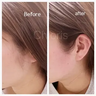 川越ローマピンク 光脱毛＆ワックス脱毛のエステ・リラクイメージ