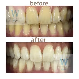 ホワイトニング ショップ船橋店🦷のエステ・リラクイメージ