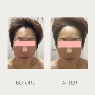 ピーリングケア 🤍moekoのエステ・リラクイメージ