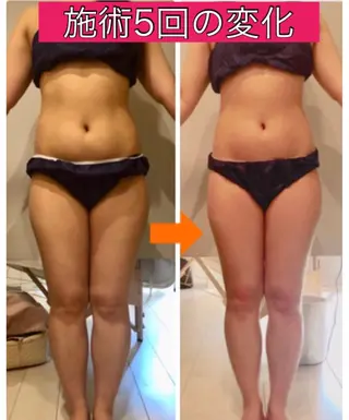 ショート カラー パーマ ヘアアレンジ メンズ キッズ ネイル マツエク・マツパ ‍痩身＆ボディ 結果出し🌟丹野のエステ・リラクイメージ