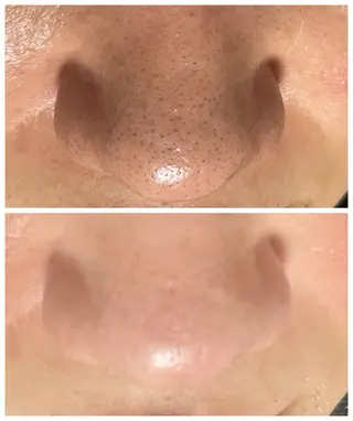 エステルーム　ラティア所属・今井 登美子のエステ・リラクイメージ