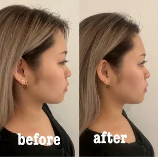 美容鍼灸サロン mahoroba院長のエステ・リラクイメージ