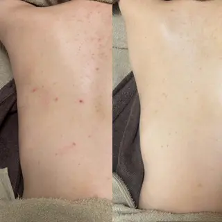 エステサロン .BX新人スタッフのエステ・リラクイメージ