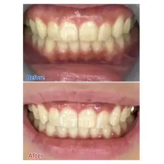 M渋谷店所属・M渋谷 ホワイトニングのエステ・リラクイメージ