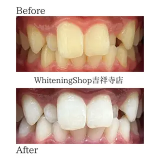 ホワイトニング ショップ吉祥寺店のエステ・リラクイメージ