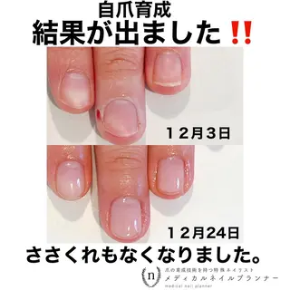 ネイル NAIL SALON ｔｏｇｇｙのネイルデザイン