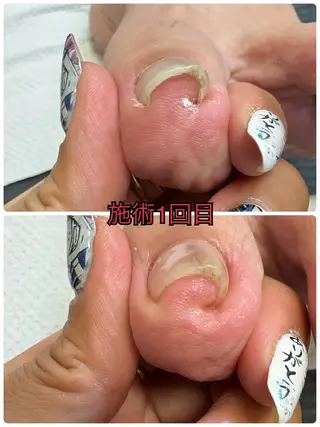 ネイル nail salon -TOIRO-所属・-TOIRO- Eriのネイルデザイン