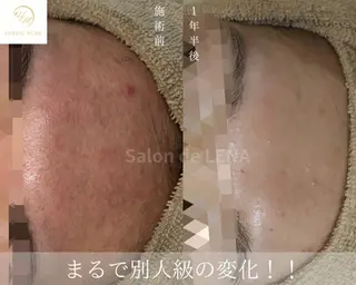 サロンドレナ名駅店所属・ハーブピーリング専門 サロンドレナ平岡のエステ・リラクイメージ