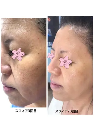 ナリスデアイム　　西宮所属・ナリス　デアイム西宮 辻　江梨那のエステ・リラクイメージ