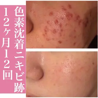 ミディアム カラー パーマ ヘアアレンジ メンズ キッズ ネイル マツエク・マツパ ニキビ・肌質改善専門 ♡人生が変わるサロンのエステ・リラクイメージ