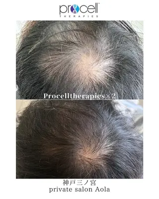 private salon Aola所属・プライベートサロン アオラのネイルデザイン