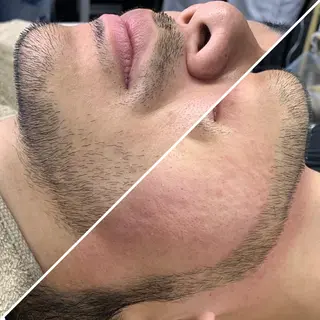 メンズ LUXY銀座店 メンズ脱毛&フェイスのエステ・リラクイメージ