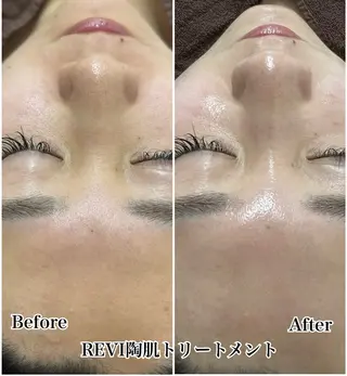 メンズ Beauty salon Guri's korugi所属・Guri's korugiのエステ・リラクイメージ