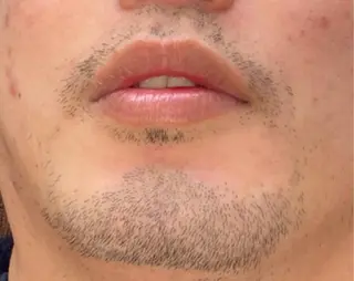 ATRIUM　 HOMMEのエステ・リラクイメージ