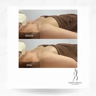 Elegance&Beauty バストアップ専門店所属・Elegance &Beauty 船橋のエステ・リラクイメージ