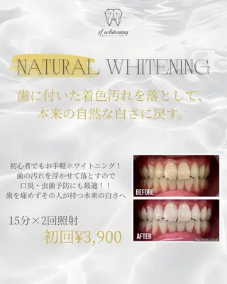 if_whitening柏原店所属・棟久 香澄のその他イメージ