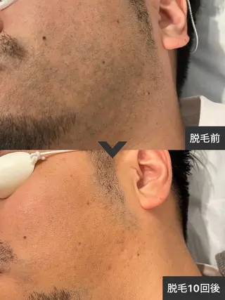 ELEGANCE所属・メンズ脱毛サロン BRIGHTのエステ・リラクイメージ