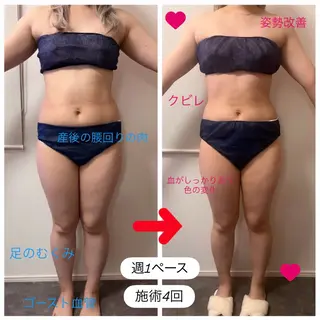 本気で痩せたい方へ 痩身専門サロンのその他イメージ