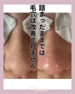 毛穴専門サロン Hanabiのエステ・リラクイメージ